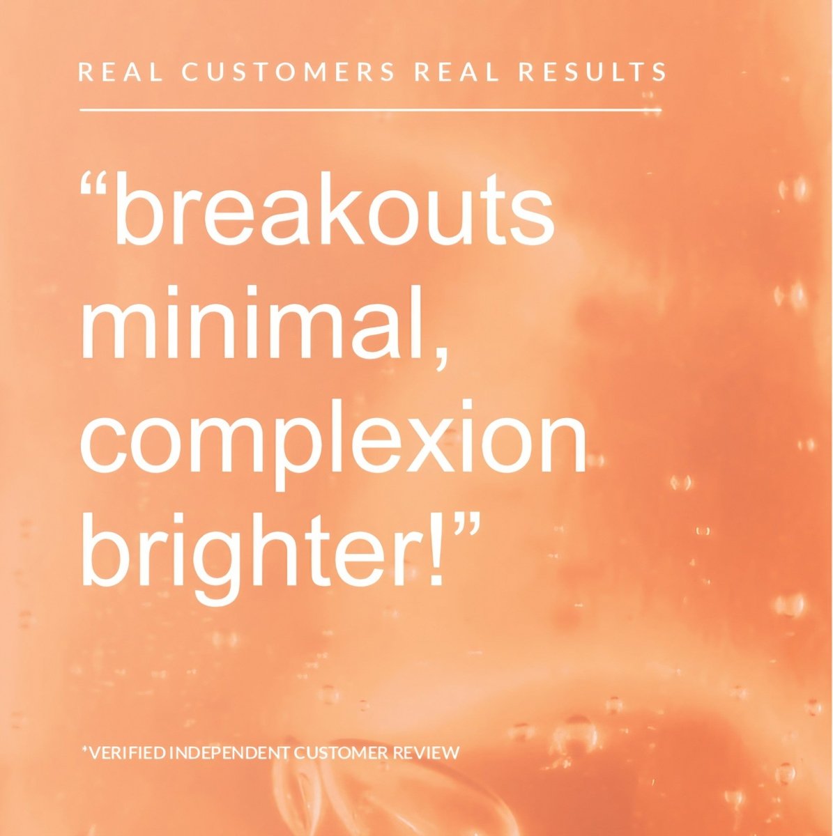 Super Rich Gentle Exfoliator - www.skin-rg.com
