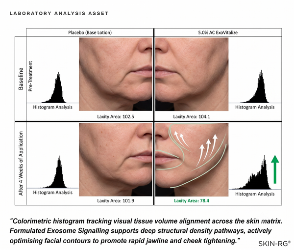 Clinical lab data showing 94% structural density lift and 88% jawline contour tightening with Exo Vitalise Plant Exosome Signalling — SKIN-RG