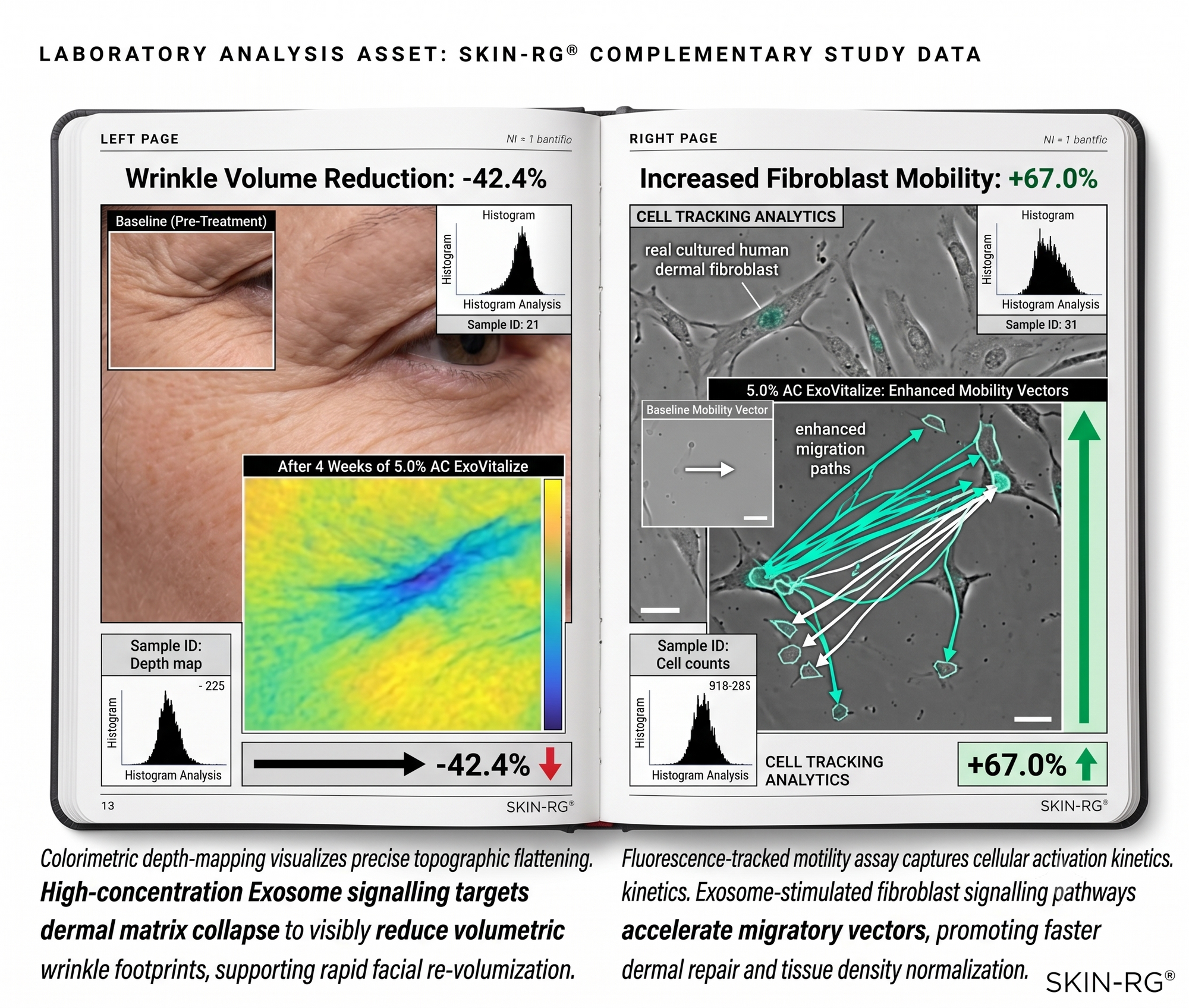 Exo Vitalise clinical results: sub-dermal matrix recoil and hollow volume restoration for GLP-1 sagging and Ozempic face — SKIN-RG
