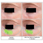 EXO ETERNOL RETINODAL™ EXOSOME : THE REBORN