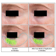 EXO ETERNOL RETINODAL™ EXOSOME : THE REBORN