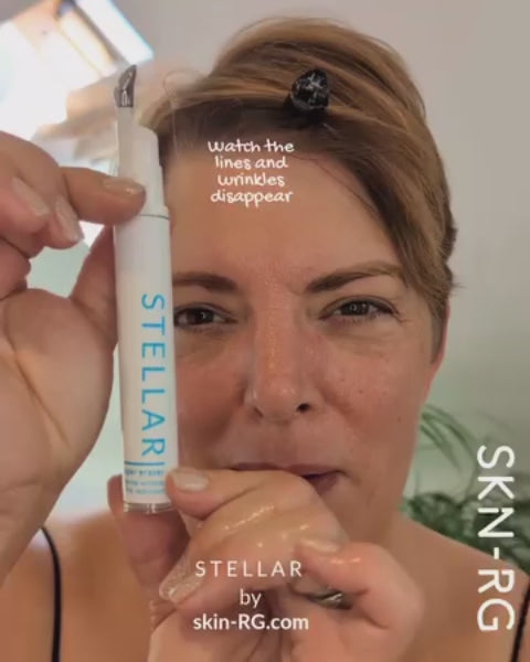 Deborah Scott Founder Of SKin-rg Skincare using Stellar Super Serum Wrinkle and line eraser
